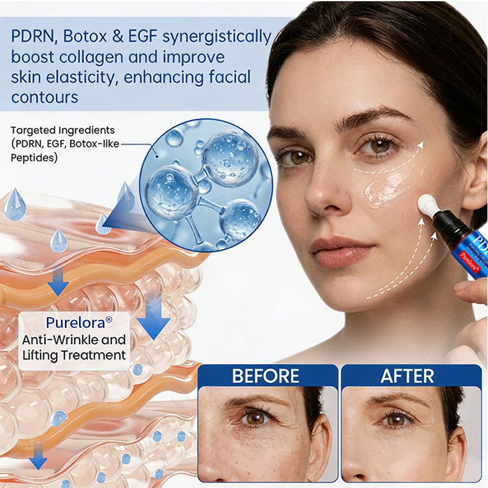 💎👨‍⚕️🌿Purelora® PDRN Anti-Wrinkle Shot – Lift & Firming Cream