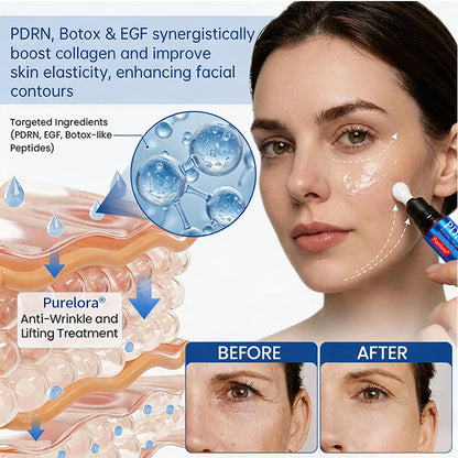 💎👨‍⚕️🌿Purelora® PDRN Anti-Wrinkle Shot – Lift & Firming Cream