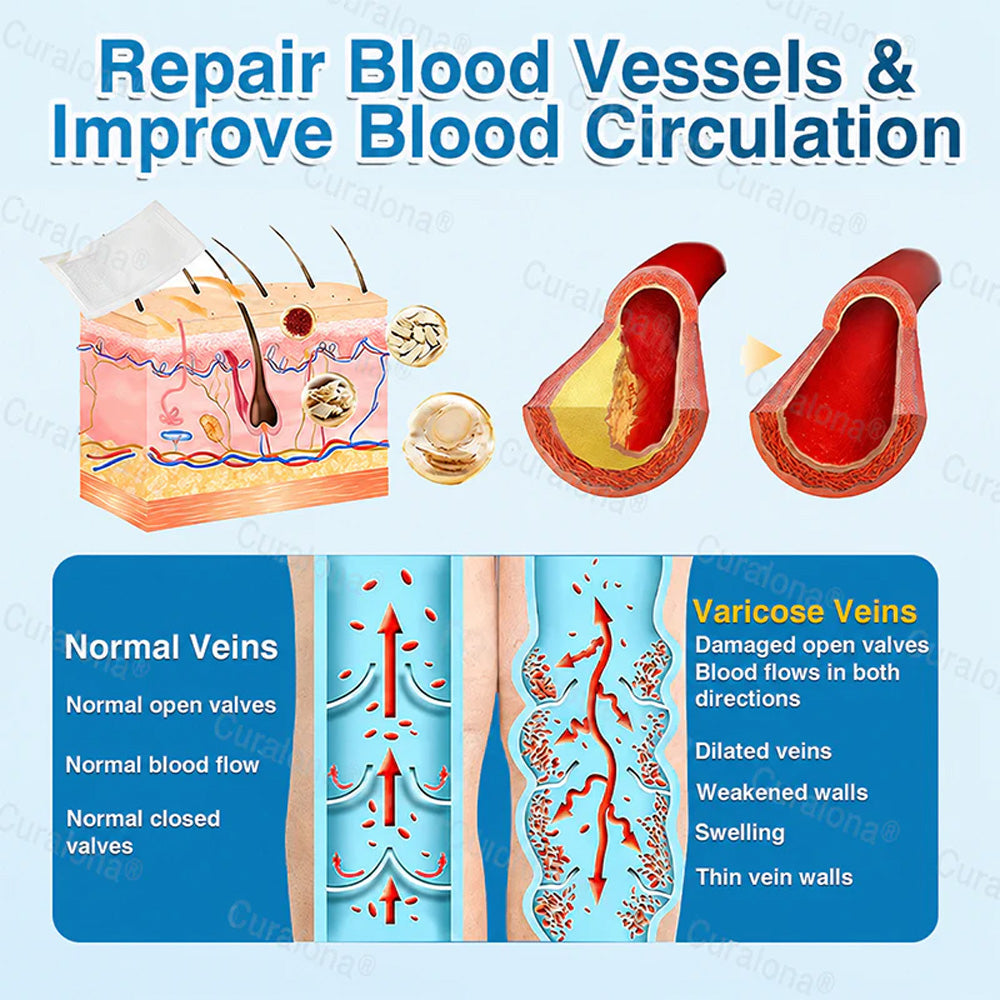 🇦🇺🏆✅️🏃 Curalona® VeinRepair Microneedle Patch Roll ⚡ Instant Relief, Long-Term Results