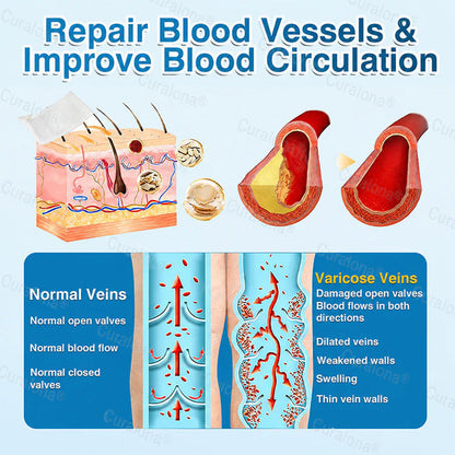 🇦🇺🏆✅️🏃 Curalona® VeinRepair Microneedle Patch Roll ⚡ Instant Relief, Long-Term Results