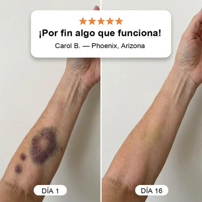 💥Más de 100.000 unidades vendidas💕 - Crema PURELORA® para reparar hematomas y fortalecer la piel