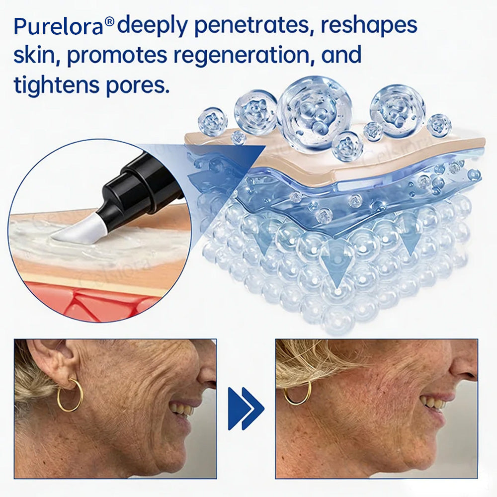 💎👨‍⚕️🌿Purelora® PDRN Anti-Wrinkle Shot – Lift & Firming Cream