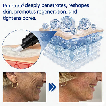 💎👨‍⚕️🌿Purelora® PDRN Anti-Wrinkle Shot – Lift & Firming Cream