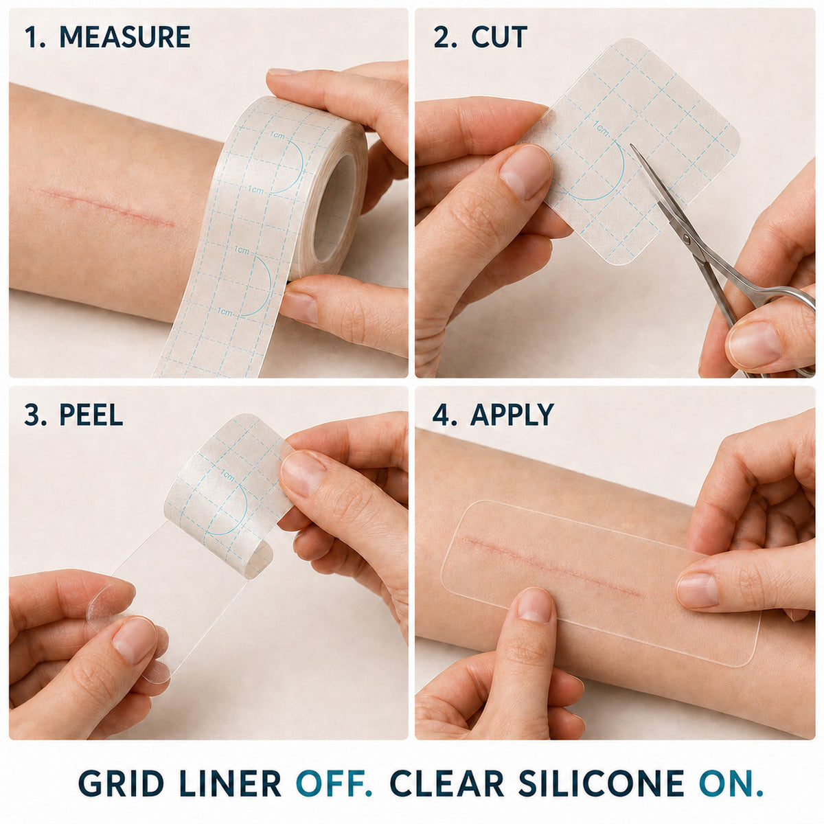 🇦🇺👩‍⚕️✨Purelora® SILICONE SCAR THERAPY ROLL Help Soften, Flatten & Improve the Appearance of Raised Scars