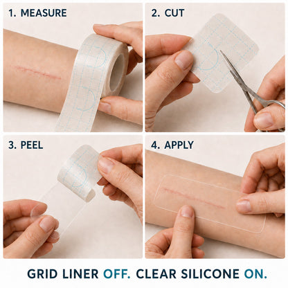 🇦🇺👩‍⚕️✨Purelora® SILICONE SCAR THERAPY ROLL Help Soften, Flatten & Improve the Appearance of Raised Scars