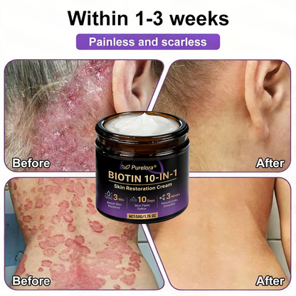 Made and Shipped from the AU 🍁 Purelora® Biotin 10-in-1 Skin Repair Cream — Last Day of Sale: 75% Off