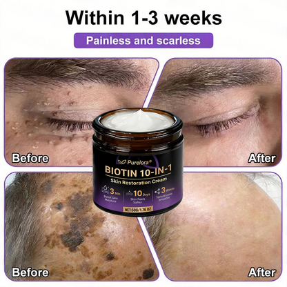 Made and Shipped from the AU 🍁 Purelora® Biotin 10-in-1 Skin Repair Cream — Last Day of Sale: 75% Off