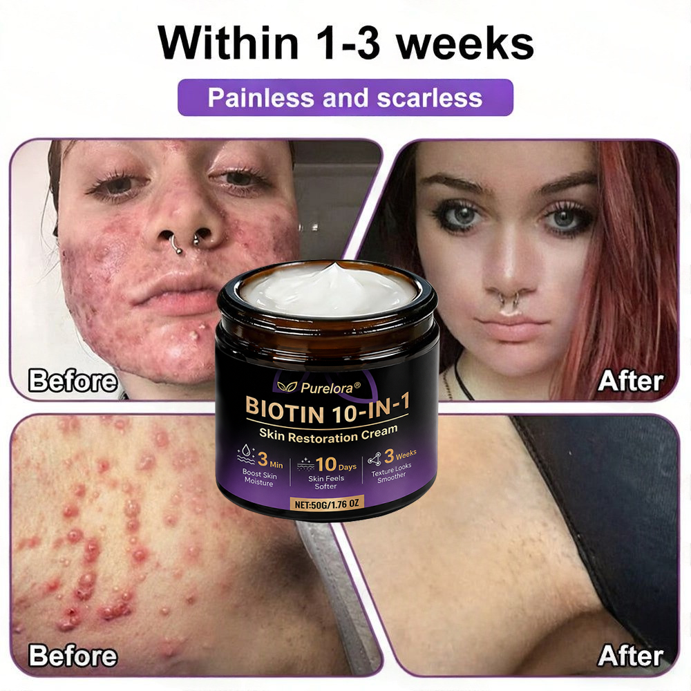 Made and Shipped from the AU 🍁 Purelora® Biotin 10-in-1 Skin Repair Cream — Last Day of Sale: 75% Off