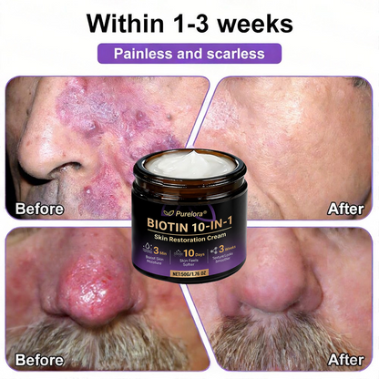 Made and Shipped from the AU 🍁 Purelora® Biotin 10-in-1 Skin Repair Cream — Last Day of Sale: 75% Off