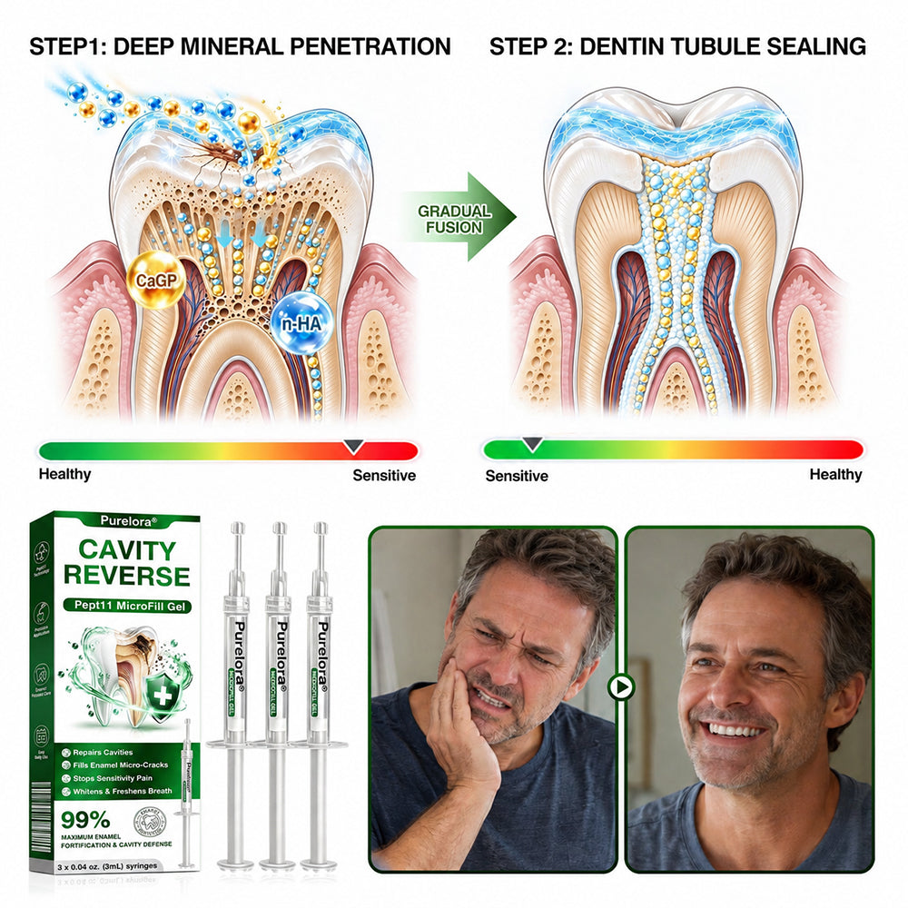 🇦🇺👨‍⚕️🦷✨Purelora® CavityReverse Pept11 MicroFill Gel