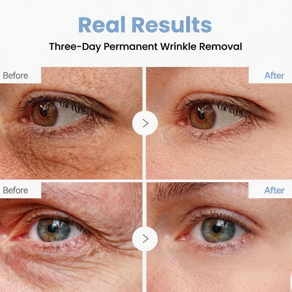 💎👨‍⚕️🌿Purelora® PDRN Anti-Wrinkle Shot – Lift & Firming Cream