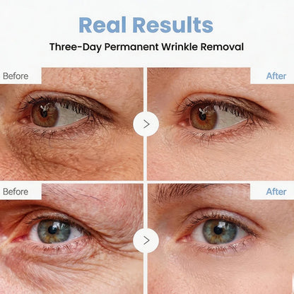 💎👨‍⚕️🌿Purelora® PDRN Anti-Wrinkle Shot – Lift & Firming Cream