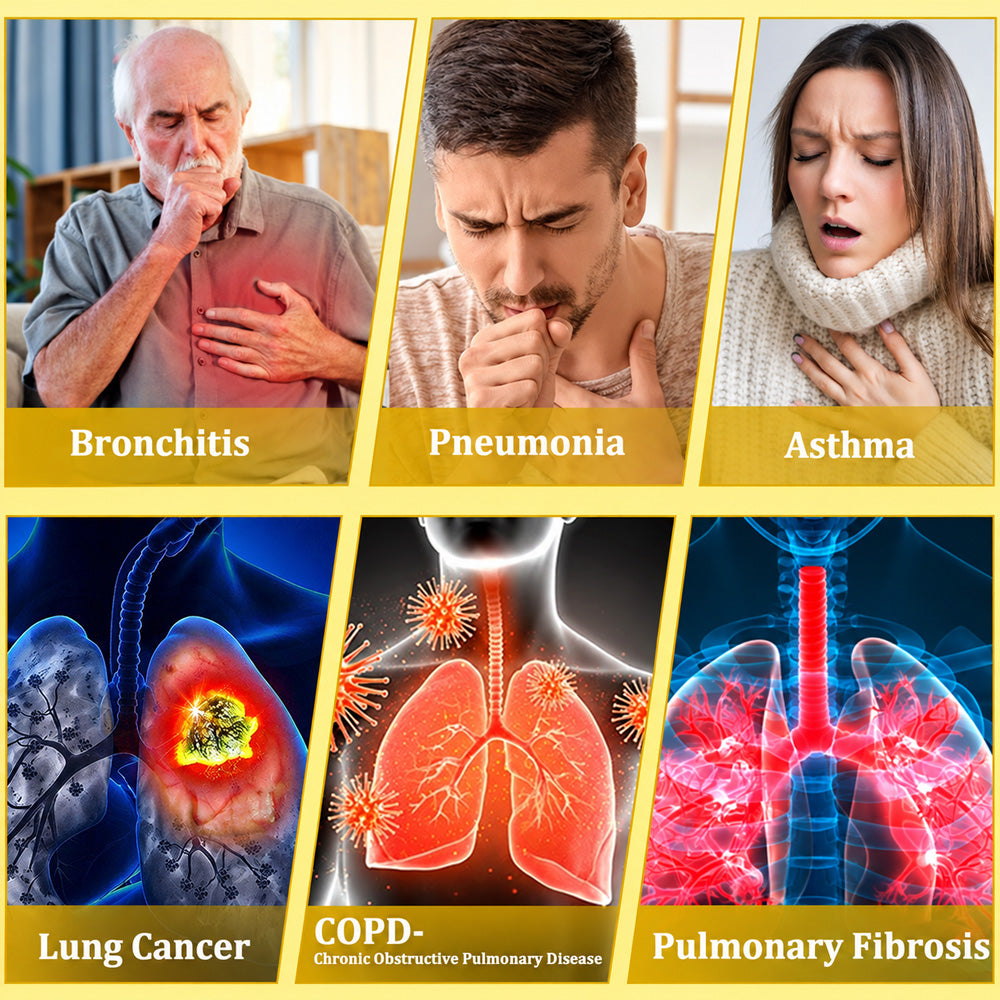 👨‍⚕️👑✅🇦🇺 Purelora® 6-in-1 Herbal BeePropolis Lung Cleanse Spray（👨‍⚕️Directly acts on COPD, asthma, chronic bronchitis (CB), respiratory infections, lung cancer, sinusitis, and other conditions🫁)