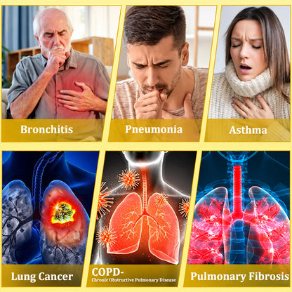 👨‍⚕️👑✅🇦🇺 Purelora® 6-in-1 Herbal BeePropolis Lung Cleanse Spray（👨‍⚕️Directly acts on COPD, asthma, chronic bronchitis (CB), respiratory infections, lung cancer, sinusitis, and other conditions🫁)
