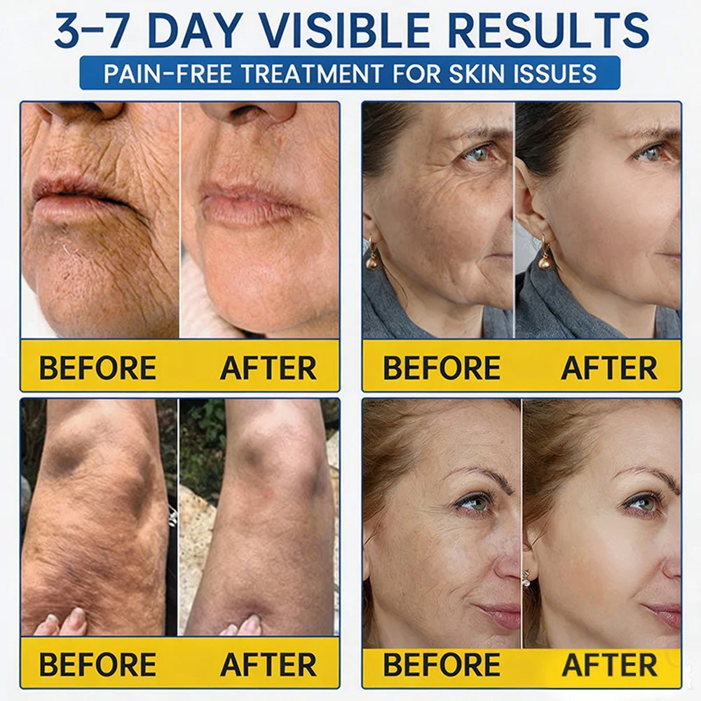 💎👨‍⚕️🌿Purelora® PDRN Anti-Wrinkle Shot – Lift & Firming Cream