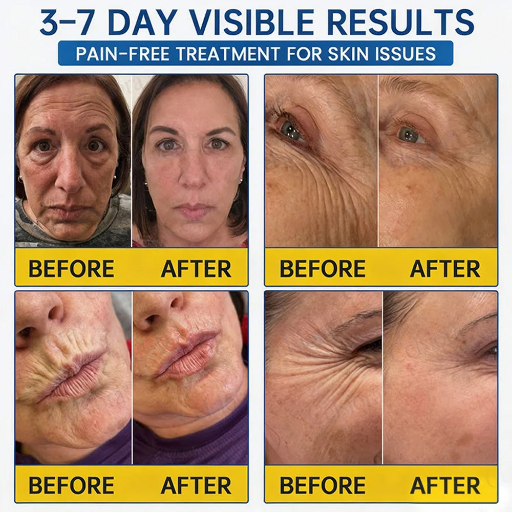 💎👨‍⚕️🌿Purelora® PDRN Anti-Wrinkle Shot – Lift & Firming Cream
