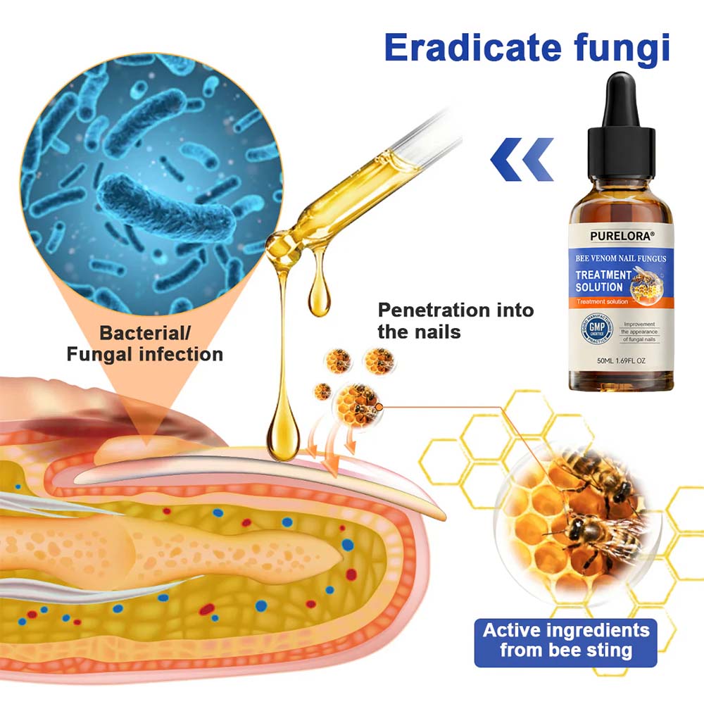 PURELORA® 👣Bee Venom Nail Fungus Treatment Solution👣