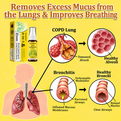 👨‍⚕️👑✅🇦🇺 Purelora® 6-in-1 Herbal BeePropolis Lung Cleanse Spray（👨‍⚕️Directly acts on COPD, asthma, chronic bronchitis (CB), respiratory infections, lung cancer, sinusitis, and other conditions🫁)